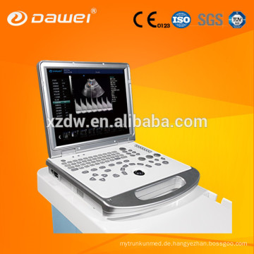 Farb-Doppler-Ultraschall-Scanner DW-C60 DAWEI Marke &amp; 15 Zoll LED-Bildschirm Laptop Sonosite Ultraschall